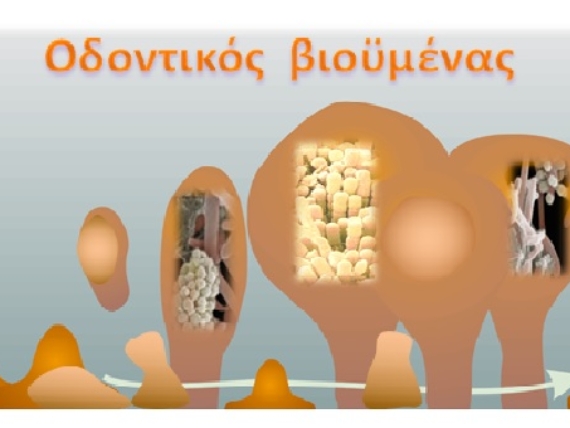 Οδοντικός βιοϋμένας, ο ρόλος και η διαχείρισή του